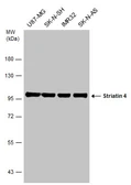 Anti-Striatin 4 antibody used in Western Blot (WB). GTX133282
