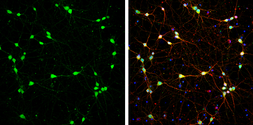 Anti-DARPP-32 antibody used in Immunocytochemistry/ Immunofluorescence (ICC/IF). GTX133336