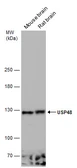 Anti-USP48 antibody used in Western Blot (WB). GTX133346