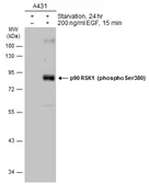 Anti-p90 RSK1 (phospho Ser380) antibody used in Western Blot (WB). GTX133467