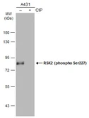 Anti-RSK2 (phospho Ser227) antibody used in Western Blot (WB). GTX133470