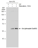 Anti-Src (phospho Tyr530) antibody used in Western Blot (WB). GTX133473