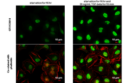 Anti-SMAD2 (phospho Ser465/Ser467) antibody used in Immunocytochemistry/ Immunofluorescence (ICC/IF). GTX133614