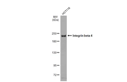 Anti-Integrin beta 4 antibody used in Western Blot (WB). GTX133651