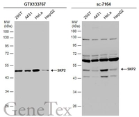 Anti-SKP2 antibody used in Western Blot (WB). GTX133767