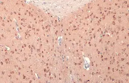 Anti-RASGRF1 antibody used in IHC (Paraffin sections) (IHC-P). GTX133775