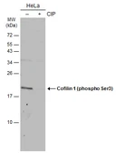 Anti-Cofilin 1 (phospho Ser3) antibody used in Western Blot (WB). GTX133865
