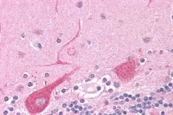 Anti-NEK6 antibody used in IHC (Paraffin sections) (IHC-P). GTX13387