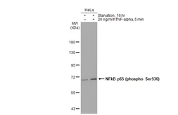 Anti-NFkB p65 (phospho Ser536) antibody used in Western Blot (WB). GTX133899
