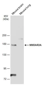 Anti-NMDAR2A antibody used in Western Blot (WB). GTX134064