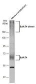 Anti-EAAT4 antibody used in Western Blot (WB). GTX134097