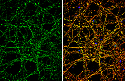 Anti-Nav1.7 antibody used in Immunocytochemistry/ Immunofluorescence (ICC/IF). GTX134494
