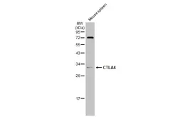 Anti-CTLA4 antibody used in Western Blot (WB). GTX134527