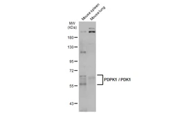 Anti-PDPK1 / PDK1 antibody used in Western Blot (WB). GTX134679
