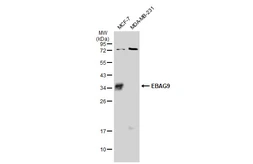 Anti-EBAG9 antibody used in Western Blot (WB). GTX134856