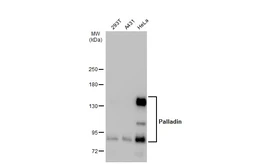 Anti-Palladin antibody used in Western Blot (WB). GTX135128