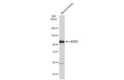 Anti-ACE2 antibody used in Western Blot (WB). GTX135404