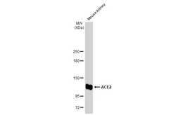 Anti-ACE2 antibody used in Western Blot (WB). GTX135406