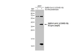 Anti-SARS-CoV-2 (COVID-19) 3CLpro (nsp5) antibody used in Western Blot (WB). GTX135470