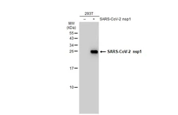 Anti-SARS-CoV-2 (COVID-19) nsp1 antibody used in Western Blot (WB). GTX135612