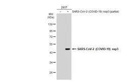 Anti-SARS-CoV-2 (COVID-19) nsp3 antibody used in Western Blot (WB). GTX135614