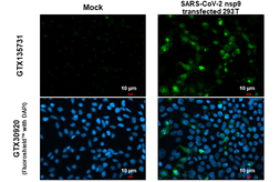Anti-SARS-CoV-2 (COVID-19) nsp9 antibody used in Immunocytochemistry/ Immunofluorescence (ICC/IF). GTX135731