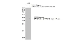 Anti-SARS-CoV-2 (COVID-19) nsp3 / PL-pro antibody used in Western Blot (WB). GTX135796