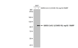 Anti-SARS-CoV-2 (COVID-19) nsp12 / RdRP antibody used in Western Blot (WB). GTX136050
