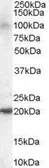 Anti-JWA antibody, C-term used in Western Blot (WB). GTX13618