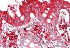 Anti-TFB2M antibody, C-term used in IHC (Paraffin sections) (IHC-P). GTX13676
