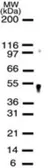 Anti-APEX2 antibody used in Western Blot (WB). GTX13691