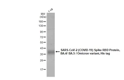 SARS-CoV-2 (COVID-19) Spike RBD Protein, Omicron / BA.4 / BA.5 variant, His tag. GTX137098-pro