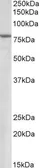 Anti-SETDB2 antibody, N-term used in Western Blot (WB). GTX13712
