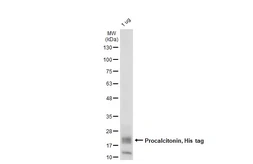 Human Procalcitonin protein, His tag. GTX138116-pro