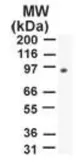 Anti-PMS2 antibody [163C1251] used in Western Blot (WB). GTX13900
