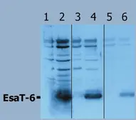 Anti-Mycobacterium tuberculosis ESAT6 antibody used in Western Blot (WB). GTX13960