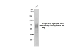 Respiratory Syncytial virus Fusion (Trimer) protein, His tag. GTX139646-pro