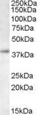 Anti-RNF2 antibody, C-term used in Western Blot (WB). GTX14751