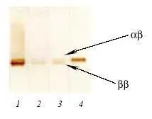 Anti-S100 antibody [4B3] used in Western Blot (WB). GTX14849