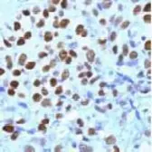 Anti-Progesterone Receptor antibody (ready-to-use) used in IHC (Paraffin sections) (IHC-P). GTX15510