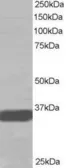 Anti-Mortality factor 4 like 2 antibody, N-term used in Western Blot (WB). GTX15700