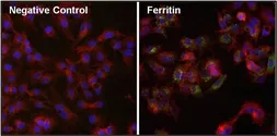Anti-Ferritin antibody [521] used in Immunocytochemistry/ Immunofluorescence (ICC/IF). GTX15742