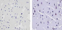 Anti-Synaptojanin 1 antibody [AC1] used in IHC (Paraffin sections) (IHC-P). GTX15835