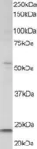 Anti-MAD4 antibody, C-term used in Western Blot (WB). GTX15841