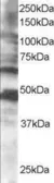 Anti-CPEB1 antibody, C-term used in Western Blot (WB). GTX15917