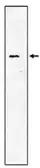 Anti-SRPR alpha antibody used in Western Blot (WB). GTX16145
