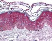 Anti-ARHGEF11 antibody used in IHC (Paraffin sections) (IHC-P). GTX16242