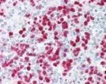 Anti-S100A8 antibody [CF-145] used in IHC (Paraffin sections) (IHC-P). GTX16249