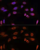 Anti-Thyroid Hormone Receptor beta antibody used in Immunocytochemistry/ Immunofluorescence (ICC/IF). GTX16393