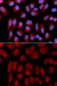 Anti-TAP2 antibody used in Immunocytochemistry/ Immunofluorescence (ICC/IF). GTX16394